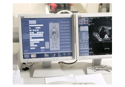 UKHSA: Medical Exposures Group